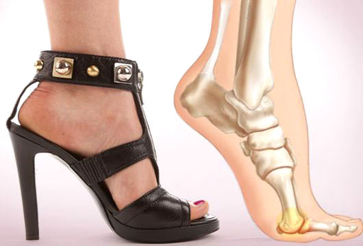 high-heels-9635-1387445093.jpg